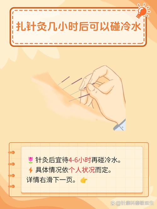 中医养生针灸如何缓解疼痛（中医针灸治疗疼痛）